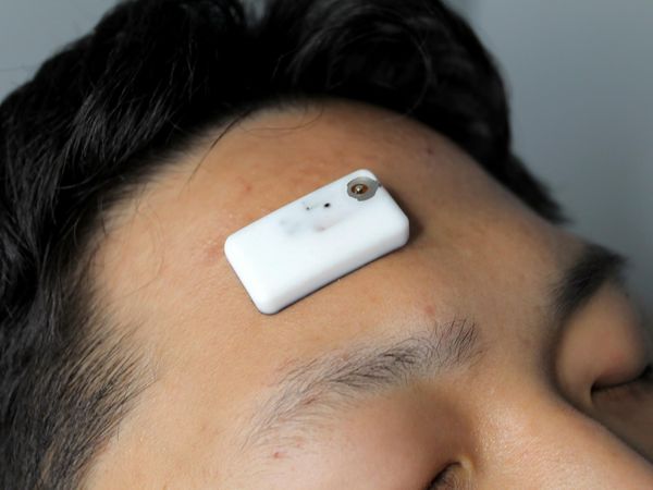 睡眠贴片:追踪大脑夜间“清洁仪式”的新利器