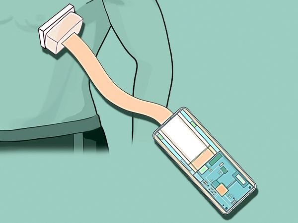 超声贴片或成未来心脏起搏器：声遗传学基因疗法成关键